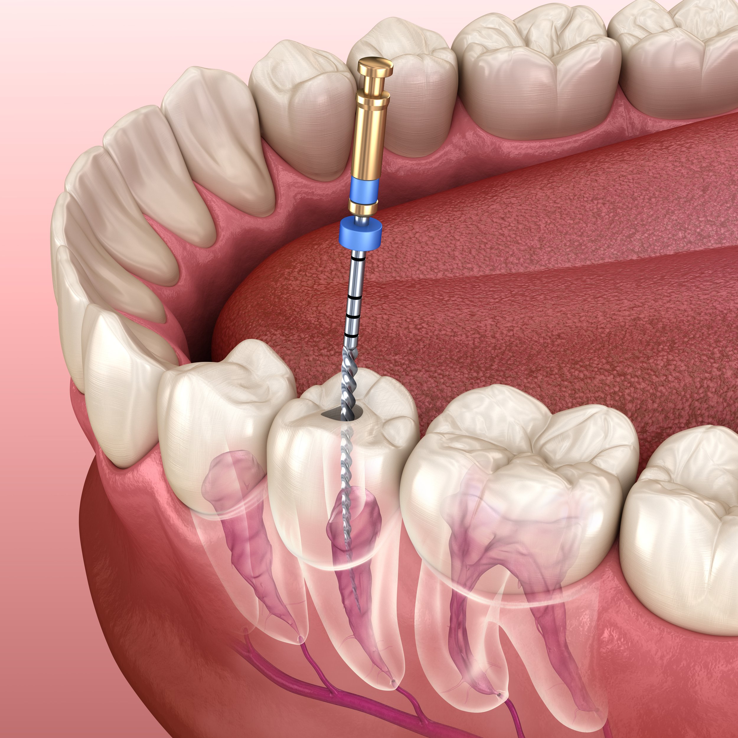 Dr Zainu's Multi Speciality Dental Clinic & Implant Centre