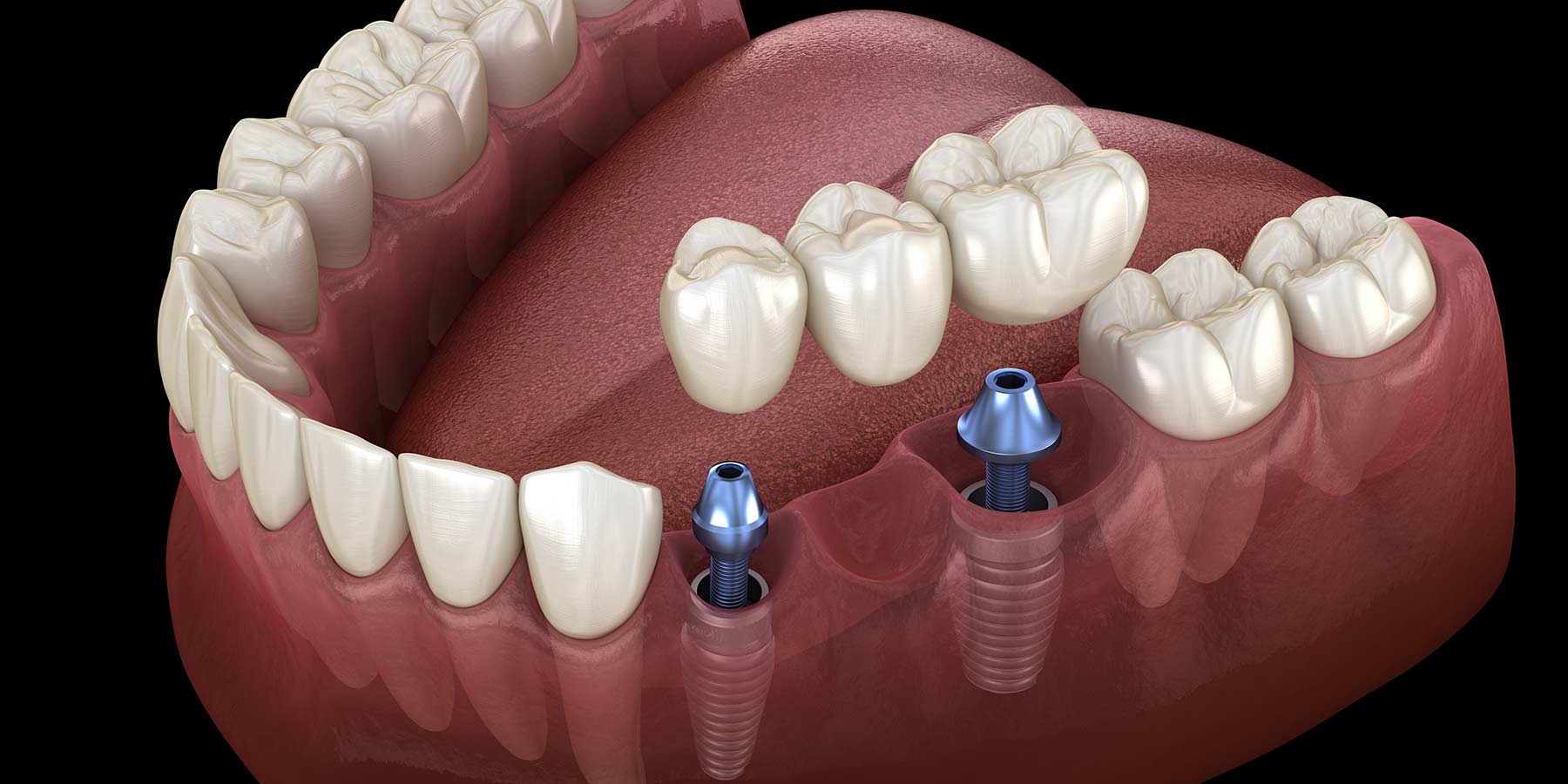 Dr Zainu's Multi Speciality Dental Clinic & Implant Centre