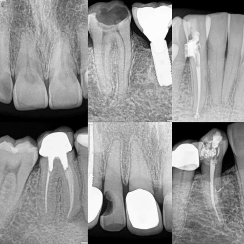 Dr Zainu's Multi Speciality Dental Clinic & Implant Centre